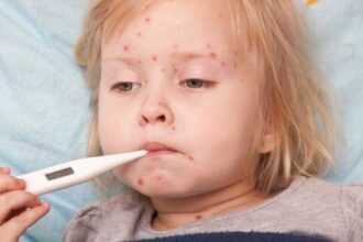 alerta sanitara in romania rujeola a revenit la nivelul de acum 50 de ani 6904db46394ec