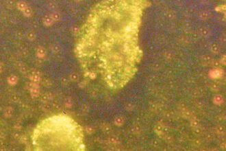 nanoparticule de aur descoperite in ace de molid cum pot influenta bacteriile din interiorul plantelor acumularea metalului in copaci 68e7bf33be093