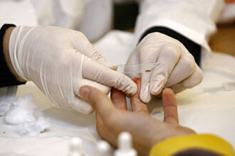 primul test de sange precis pentru detectarea sindromului de oboseala cronica 68e62514d3d4a