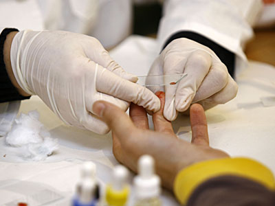 primul test de sange precis pentru detectarea sindromului de oboseala cronica 68e62514d3d4a