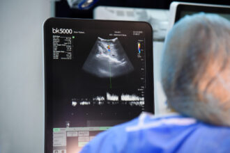 84 de donatori si aproape 300 de transplanturi in romania de la inceputul anului 692d97a4d6628