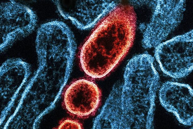 ce este virusul nipah si de ce autoritatile se tem de o epidemie 697b1b47f3777