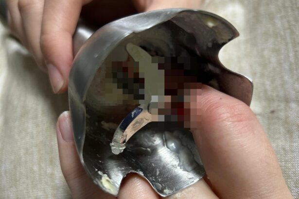 doua femei din iasi au ajuns la spital in urma unor accidente casnice grave 69d9e782963d2