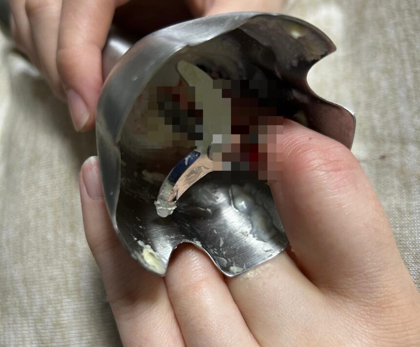 doua femei din iasi au ajuns la spital in urma unor accidente casnice grave 69d9e782963d2