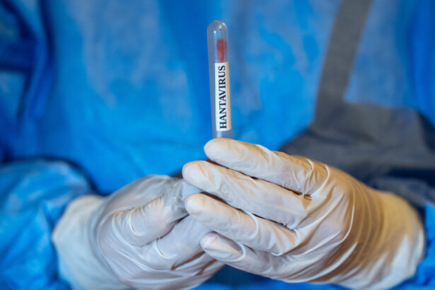 femeia internata intr un spital din alicante din cauza suspiciunii de hantavirus a iesit negativa la testul pcr 69ffadbbedabd
