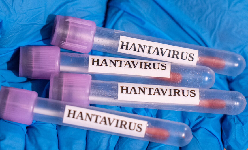 un american de pe nava mv hondius depistat usor pozitiv la testul pcr pentru tulpina andes a hantavirusului 6a01446ae5f0c