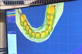 un tanar de 22 de ani ofera gratuit danturi cu ajutorul imprimantelor 3d si reda zambetele celor care nu si le permit 6a39106f79327