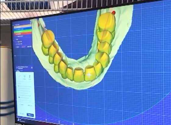 un tanar de 22 de ani ofera gratuit danturi cu ajutorul imprimantelor 3d si reda zambetele celor care nu si le permit 6a39106f79327