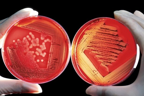 nu e magie oamenii de stiinta anunta ca sunt la un pas sa produca alimente din aer cu ajutorul unor bacterii 6a58e209200cf