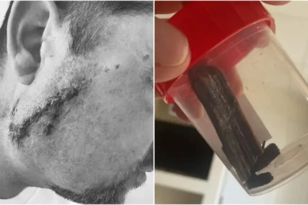 este revoltator ce a patit un pacient dupa ce a ajuns la spital din satu mare un ginecolog i a cusut rana dar in obraz ramasese o bucata de lemn 6a86dfd8266a8